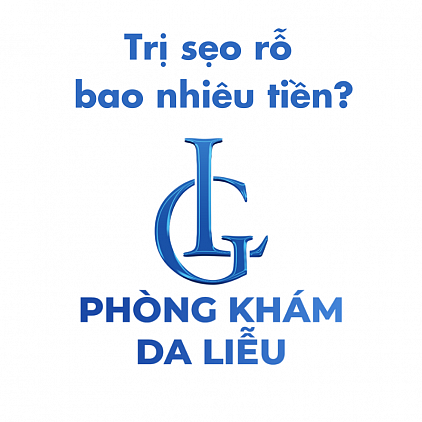 tri-seo-ro-bao-nhieu-tien